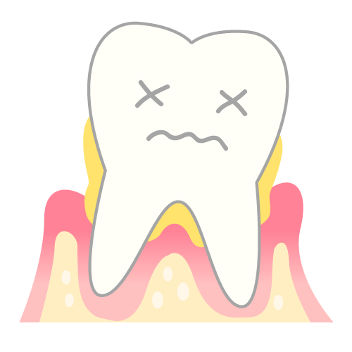 歯茎から膿が出たときの注意点と治療法を解説