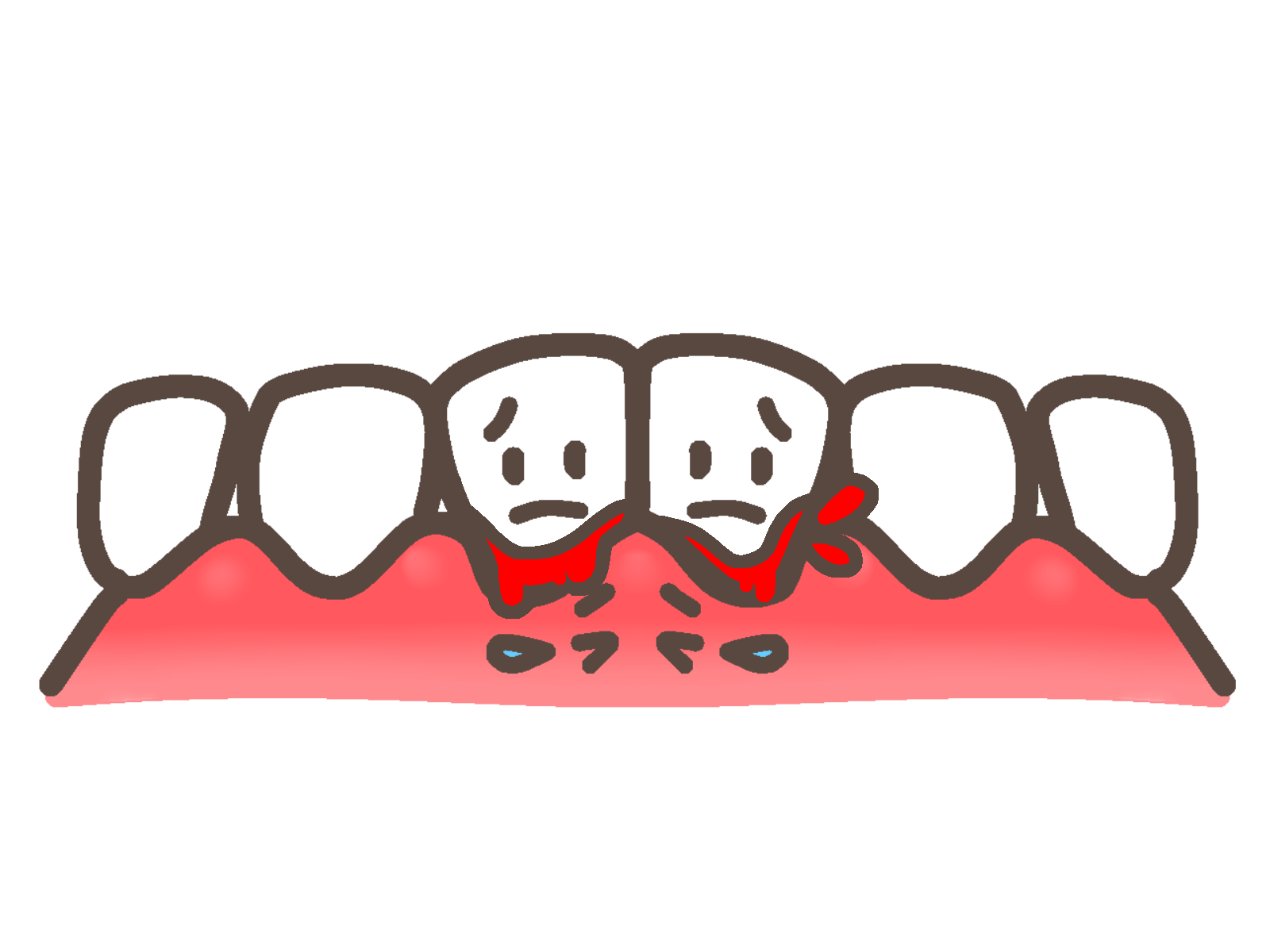 歯ぐきから血が出るのは歯周病のサイン？原因と対策、放置するリスクを徹底解説！